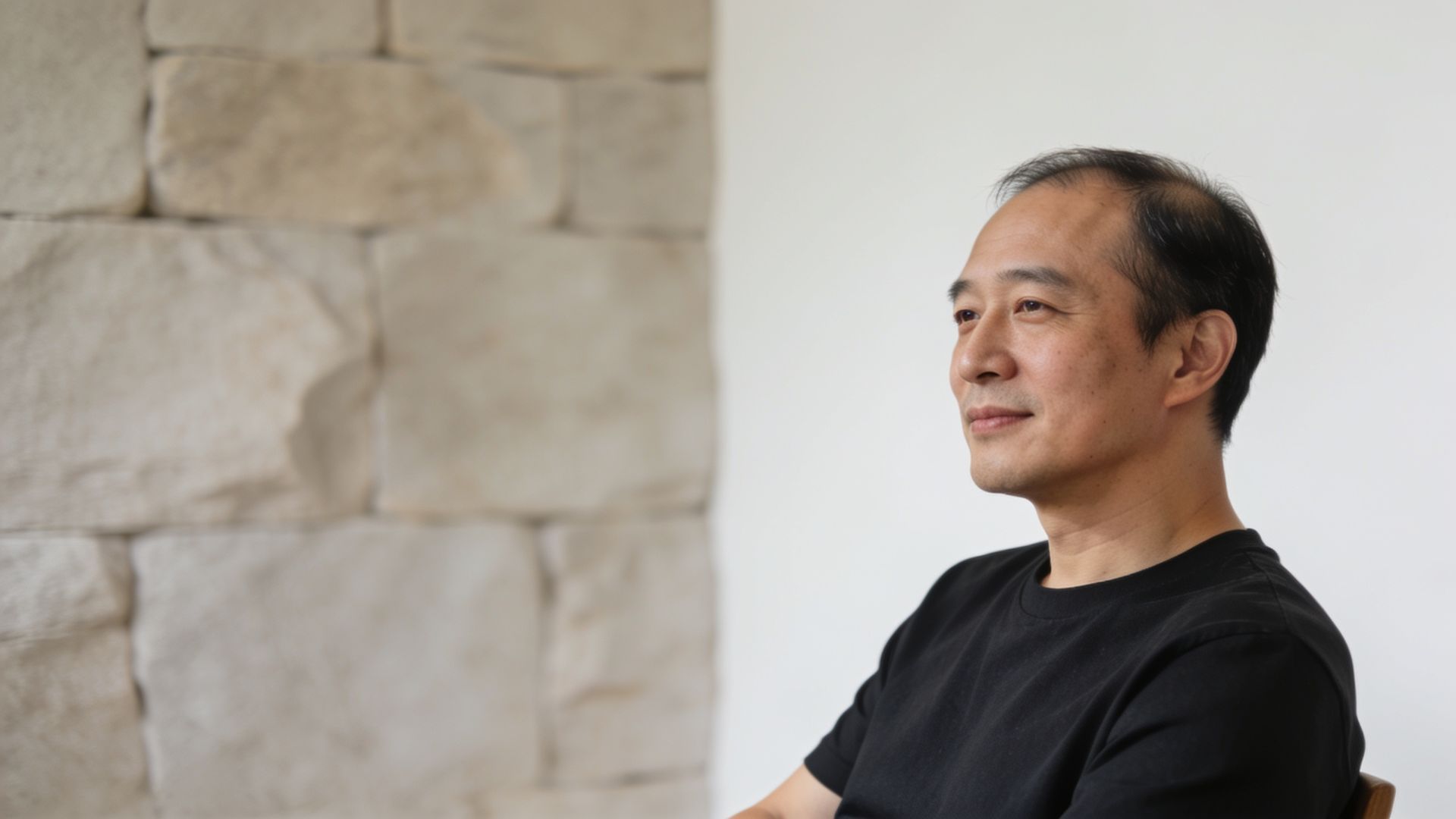Man with early thinning at the temples, representing hair loss assessment