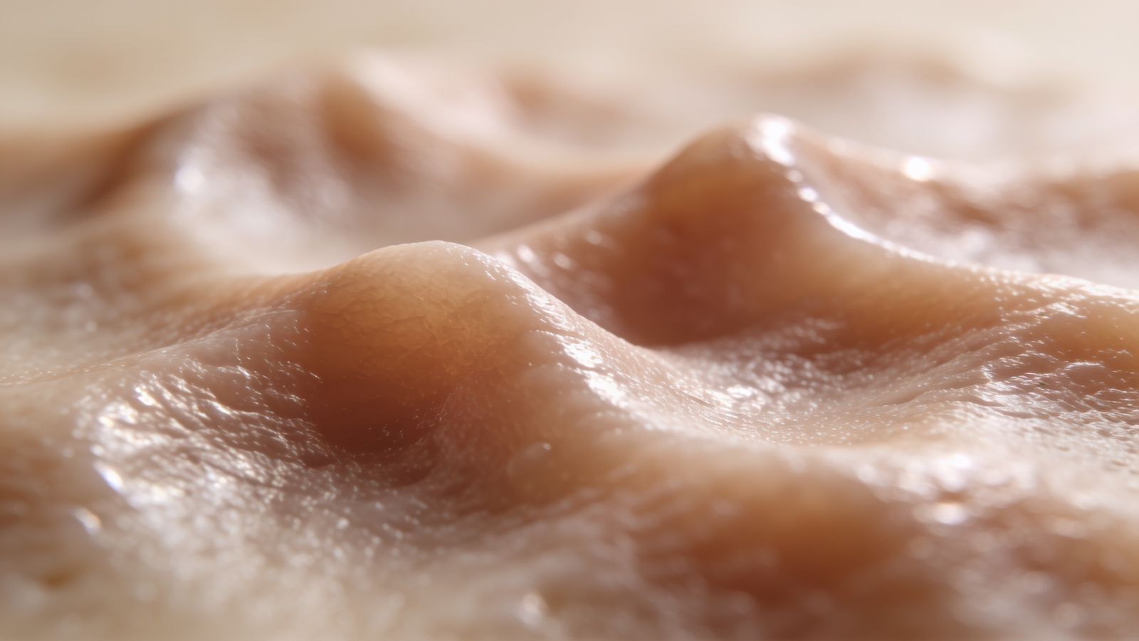 RF Microneedling — illustrative