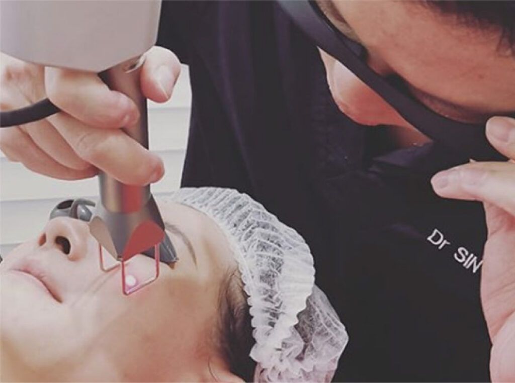 4D Scar Reconstruction | Scar Rrevision Surgery Singapore