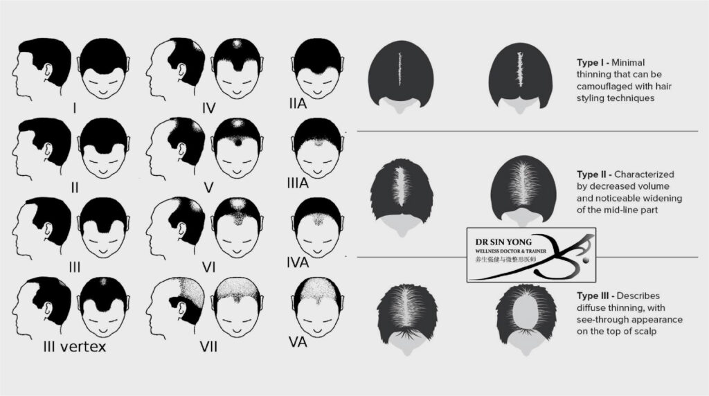 Anti Hair Loss Medications | Regenera Activa