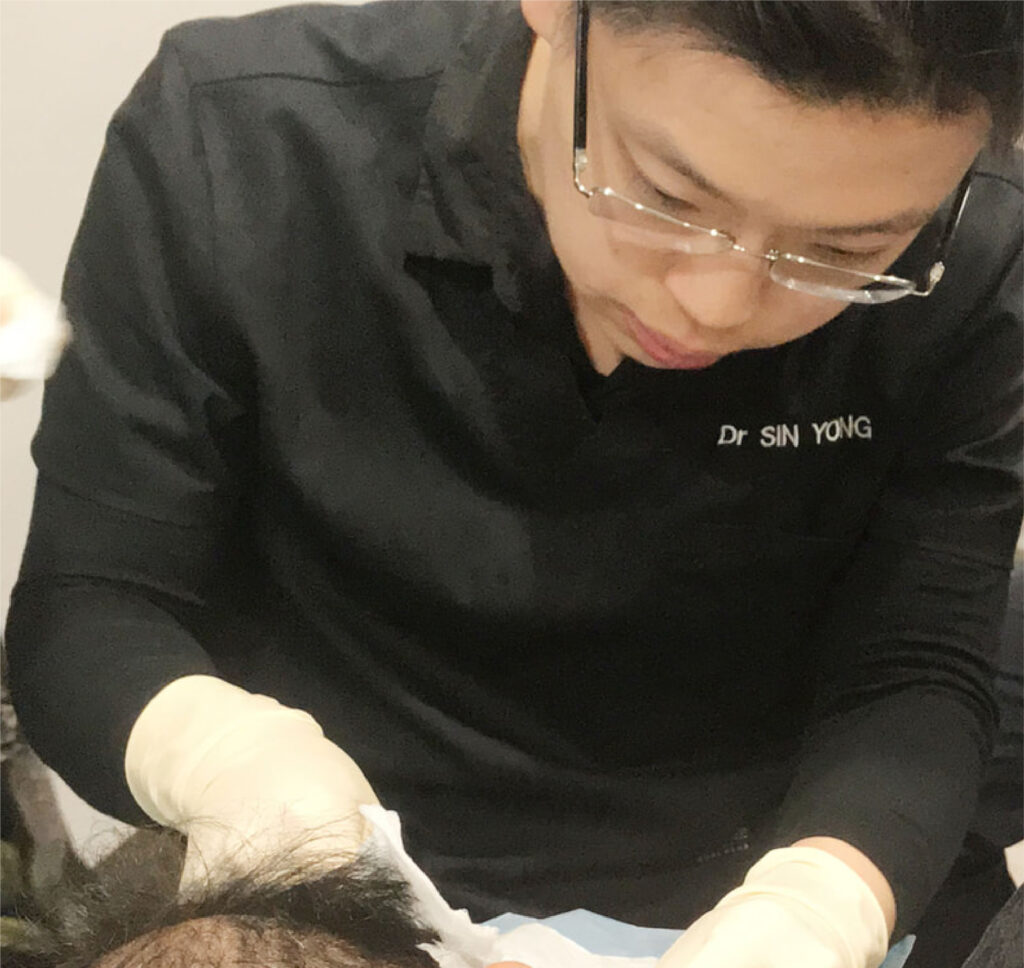 Anti Hair Loss Medications | Regenera Activa