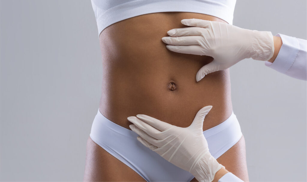 Cellulite Redefined Treatment | Cellulite Thighs, Buttock, Abdomen