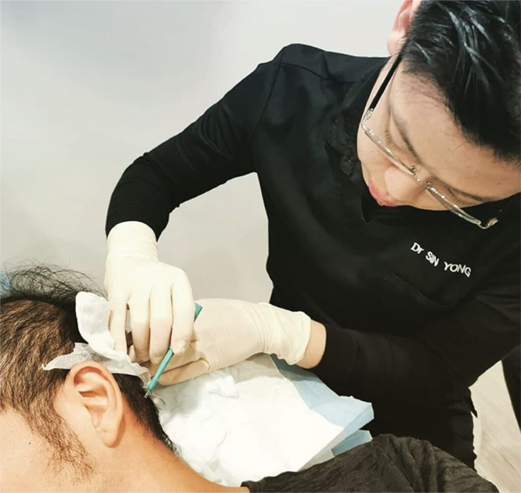 Growth Factors Treatment for Hair Loss | Stem Cell Regeneration