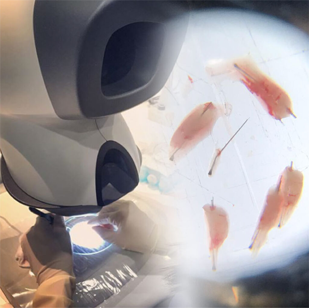 Hair Transplantation Procedure & Treatment