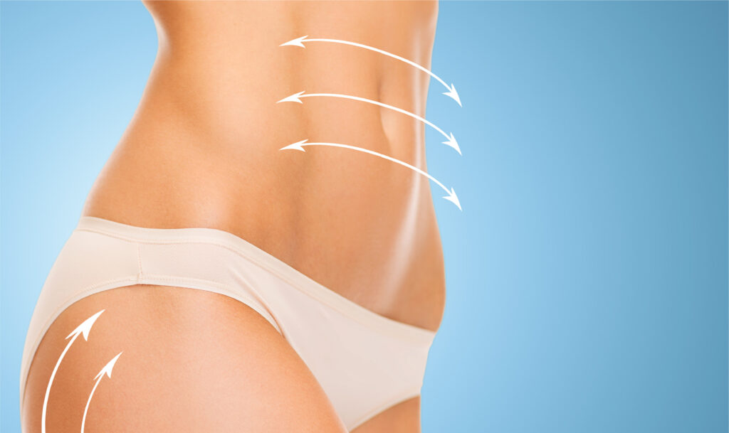 Svelte Touch - The Fat Recontouring Process