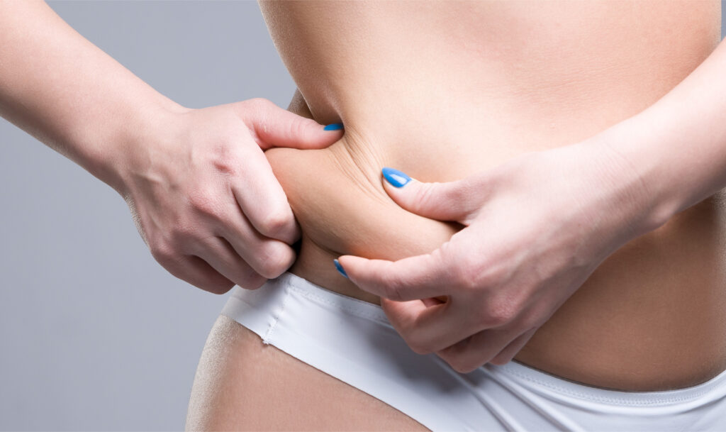 Svelte Touch - The Fat Recontouring Process