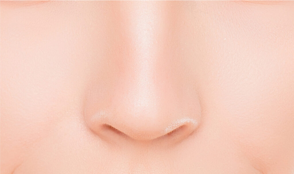Nose Filler To Enhance The projection of Nose