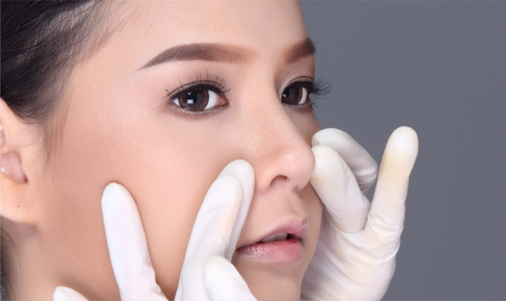 Nose Filler To Enhance The projection of Nose