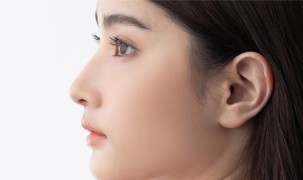Nose Filler To Enhance The projection of Nose