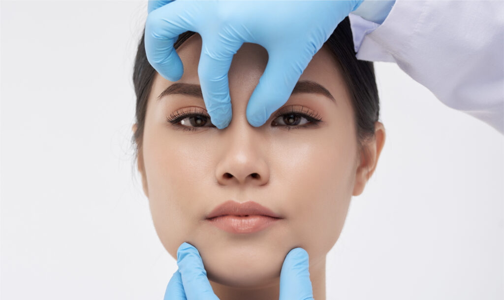 Thread lifts - The Bliss Lift | Ultra V Face Lift