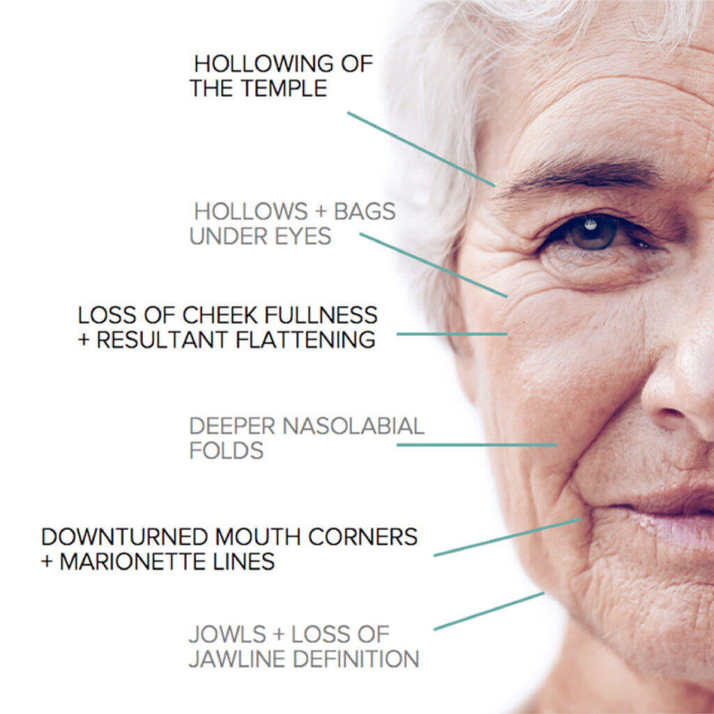Volume Restoration | Facial Restoration Treatment