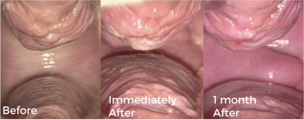 G Lift - Women Wellness | Viginal Dryness, Itches Treatment