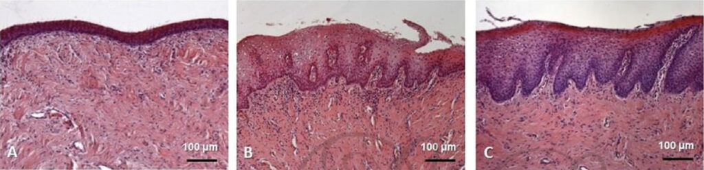 G Lift - Women Wellness | Viginal Dryness, Itches Treatment