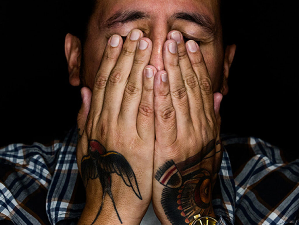 Tattoo Laser Removal Treatment Near Me