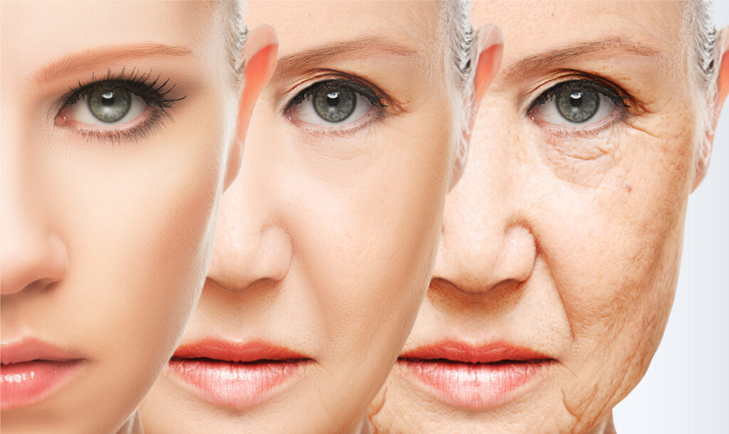 Wrinkles Prevention Botox for Wrinkles & Jawline contouring
